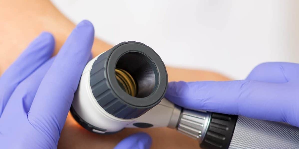 Skin Cancer Awareness: What is Skin Cancer?