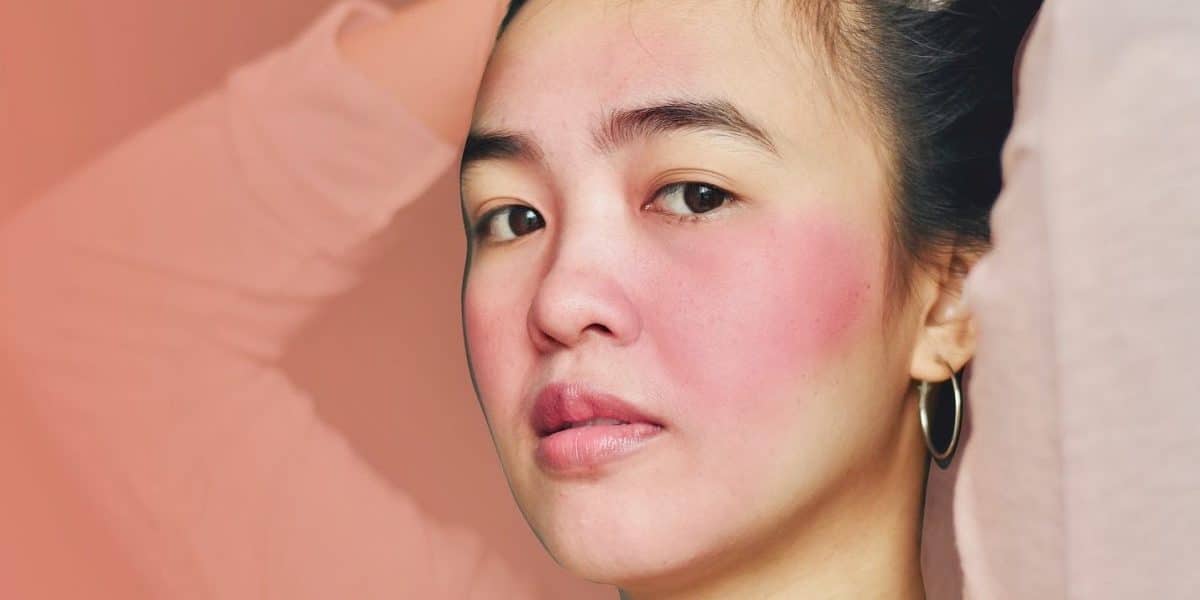 Rosacea Friendly Skin Care Products